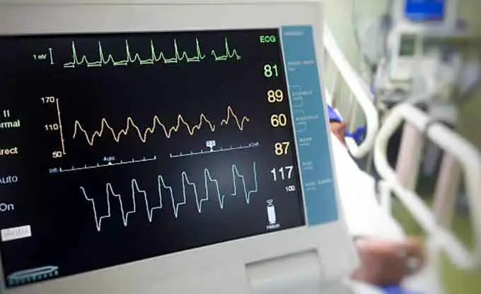 Uses of Patient Monitor